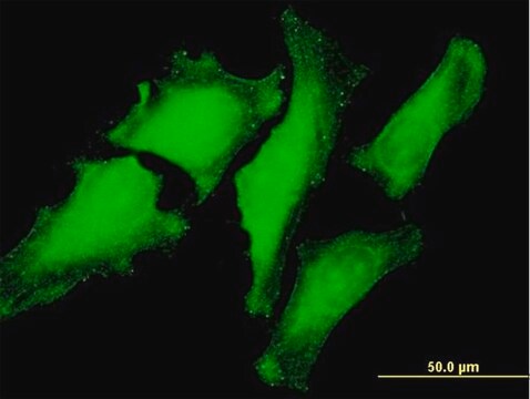 Monoclonal Anti VBP1 Antibody Produced In Mouse Clone 3D11 Purified