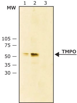 LAP2 TMPO Monoclonal Antibody Western ELISA Immunocytochemistry L6043