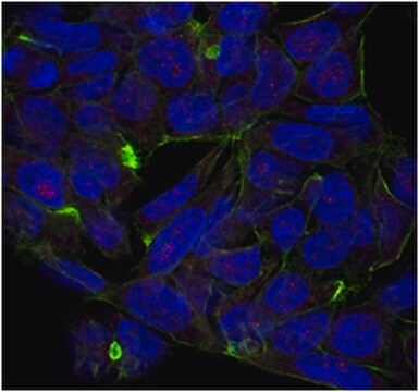 Anti VPS41 Antibody From Rabbit Purified By Affinity Chromatography