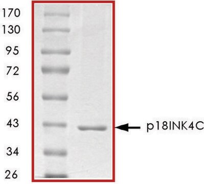 P Ink C Gst Tagged Human Recombinant Expressed In E Coli Sds