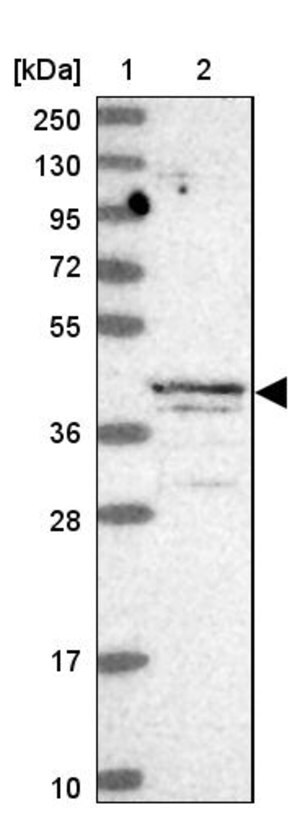 Anti-ALKBH1 antibody produced in rabbit Prestige Antibodies® Powered by ...