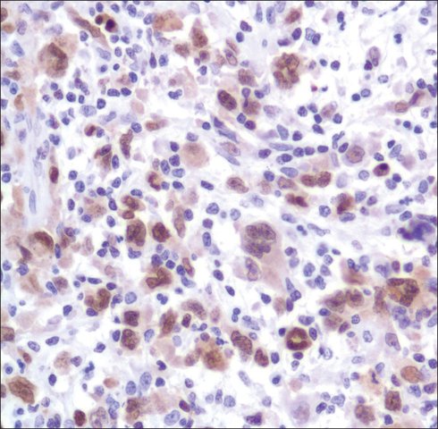 Anti-MUM1/IRF4 antibody Rabbit | SAB5500147-100UL | SIGMA-ALDRICH | SLS