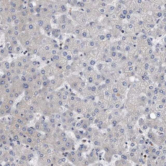 Anti-CD200 antibody produced in rabbit Prestige Antibodies® Powered by ...