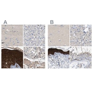 Anti Serpinb5 Antibody Produced In Rabbit Prestige Antibodies Powered By Atlas Antibodies Affinity Isolated Antibody Buffered Aqueous Glycerol Solution Sigma Aldrich