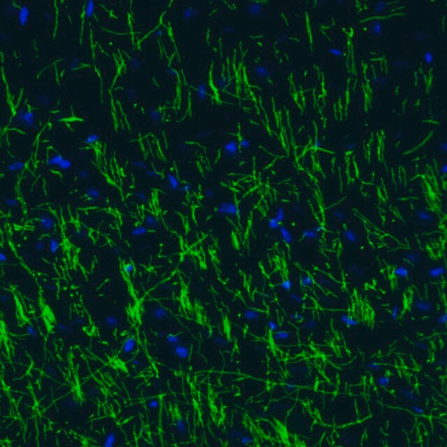 Monoclonal Anti-MBP antibody produced in mouse Prestige Antibodies ...