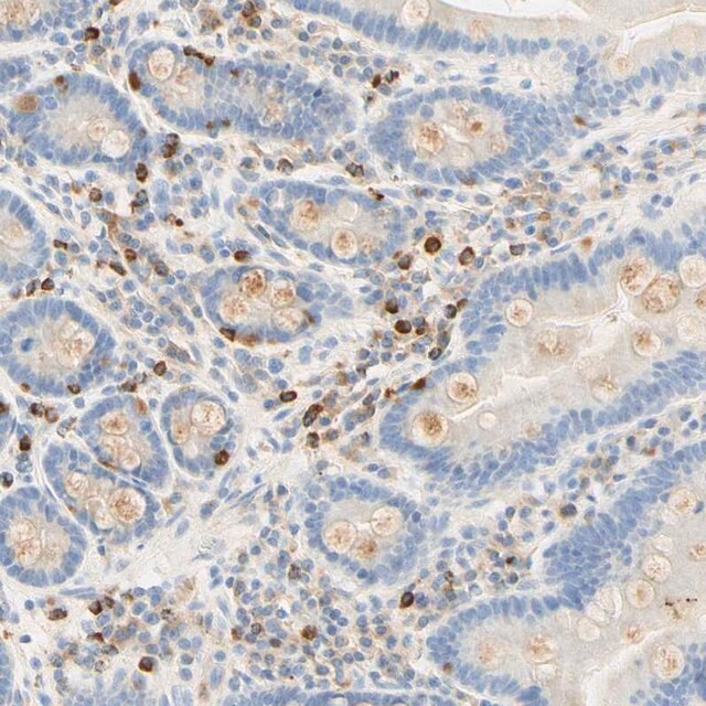 Anti-CD63 antibody produced in rabbit Prestige Antibodies® Powered by ...