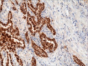 SAB5600258_Anti-SP-B (Surfactant Protein B) Antibody, Rabbit Monoclonal ...