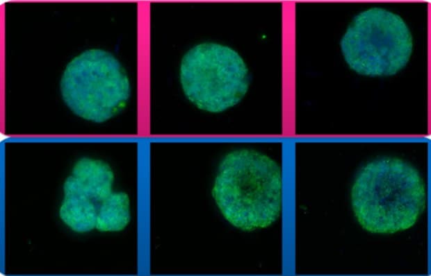 Confocal microscopy of HeLa cells using Millicell ULA and Competitor A ULA plates