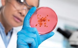 Scientist inspecting bacterial growth on a transparent petri dish with a stack of additional cultured samples to examine.