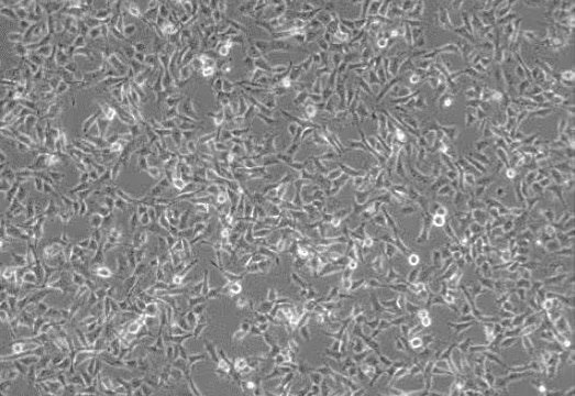 Brightfield image of HT1080 fibrosarcoma cells cultured in PromoCell® Cancer Cell Line Medium XF