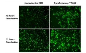 Shows 4 images, Lipofectamine 2000 and Transfectamine™ 5000 with 48 hours and 72 hours Transfection, respectively