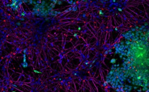 StressMarq Active Human Recombinant Alpha Synuclein Pre-Formed Fibrils (Type 1), 100 µg