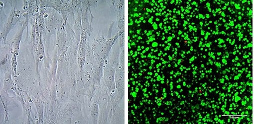 3D culture of human mesenchymal stem cells using PhotoHA®