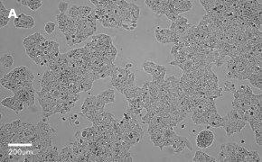 Brightfield imaging of Huh-7D12 cells on Millicell<sup>®</sup> DCI Digital Cell Imager at 10X magnification