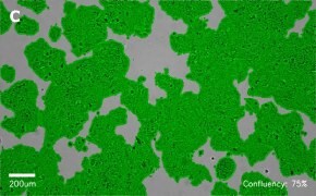 Brightfield imaging of Huh-7D12 cells on Millicell<sup>®</sup> DCI Digital Cell Imager at 10X magnification with mask