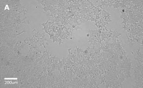 Brightfield imaging of HEK 293T cells on Millicell<sup>®</sup> DCI Digital Cell Imager at 10X magnification