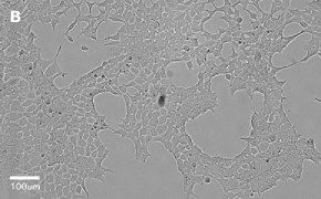 Brightfield imaging of HEK 293T cells on Millicell<sup>®</sup> DCI Digital Cell Imager at 20X magnification