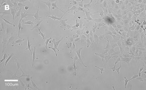 Brightfield imaging of MRC-5 SV2 cells on Millicell<sup>®</sup> DCI Digital Cell Imager at 20X magnification