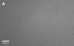 Brightfield imaging of Vero cells on Millicell<sup>®</sup> DCI Digital Cell Imager at 10X magnification