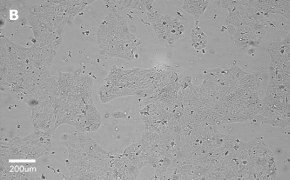 Brightfield imaging of A431 cells on Millicell<sup>®</sup> DCI Digital Cell Imager at 20X magnification