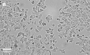 Brightfield imaging of MCF-7 cells on Millicell<sup>®</sup> DCI Digital Cell Imager at 20X magnification