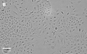 Brightfield imaging of A459 cells on Millicell<sup>®</sup> DCI Digital Cell Imager at 20X magnification