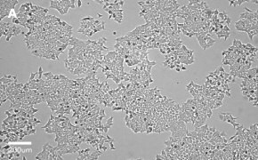 Brightfield imaging of HCT116 cells on Millicell<sup>®</sup> DCI Digital Cell Imager at 10X magnification