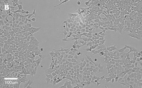 Brightfield imaging of HCT116 cells on Millicell<sup>®</sup> DCI Digital Cell Imager at 20X magnification