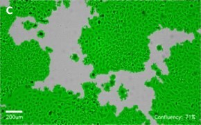 Brightfield imaging of HeLa cells on Millicell<sup>®</sup> DCI Digital Cell Imager at 10X magnification with mask