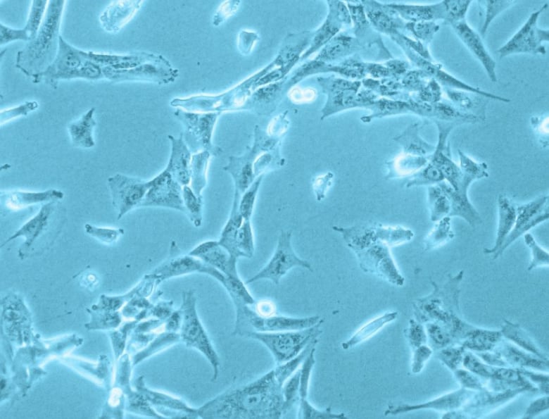 Characterization of human placenta derived vascular pericytes