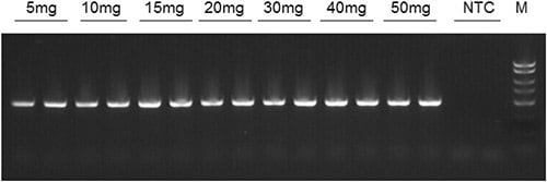 18S rDNA amplicons following end-point PCR of DNA samples