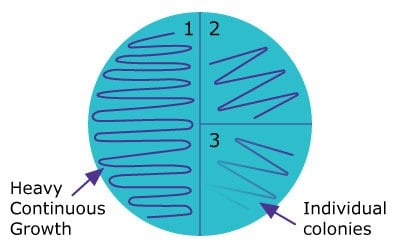 Petri dish divided into quadrants, showing varying growth patterns from heavy continuous growth to individual colonies.