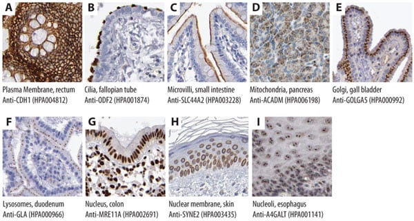 Immunohistochemical Stainings Showing Subcellular Localization