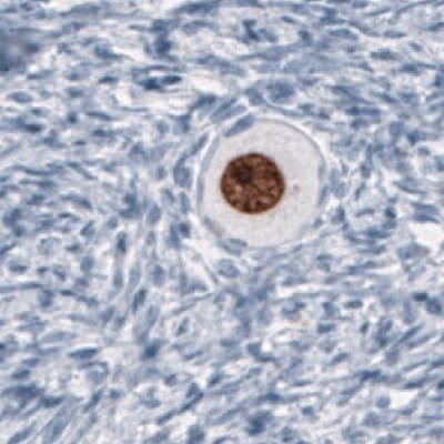 Immunohistochemical staining of human germinal cells in an oocyte using Anti-SALL4 monoclonal antibody (Product No. AMAb91769) showing nuclear positivity.