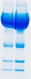 Bands of interest on SDS-PAGE obscured by abundant proteins