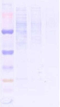 Protein concentration too low as seen on Coomassie-stained membrane