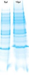 Effect of excessively low sample pH on SDS-PAGE