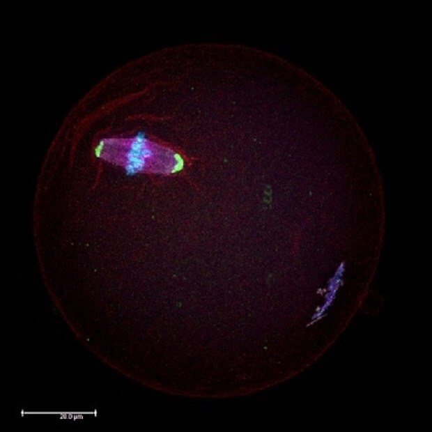 Microscopic image of mouse oocyte in the meiotic metaphase II stage.