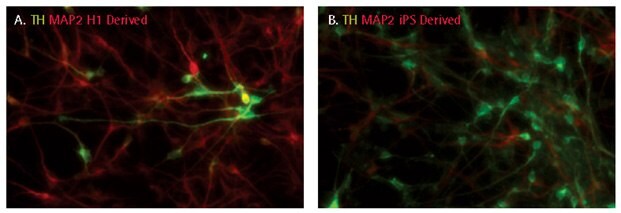 Dopaminergic differentiation of iPSC derived NPCs