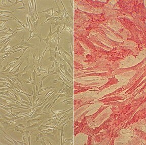 Human Pulmonary Artery Smooth Muscle Cells (HPASMC)