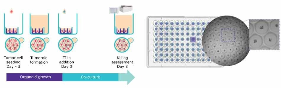 Assay workflow for the organoid formation and representative brightfield image of human colorectal tumor spheroids