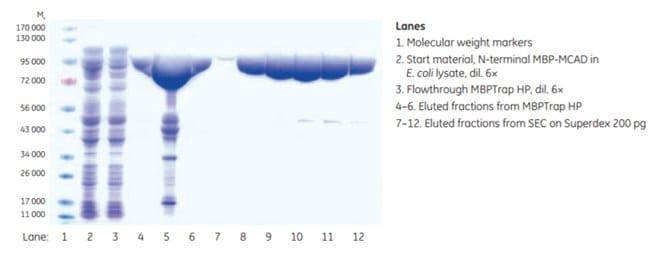 SDS-PAGE analysis