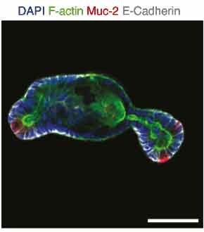 Fluorescence imaging of mucin-2 highlighting the presence of Goblet cells in organoids grown in microwell assays.