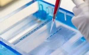 Nucleic acid samples with blue dye being pipetted into a gel for electrophoresis