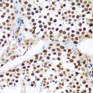 Anti-PRP19 antibody produced in rabbit