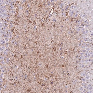 Anti-ZNF311 antibody produced in rabbit Prestige Antibodies&#174; Powered by Atlas Antibodies, affinity isolated antibody, buffered aqueous glycerol solution