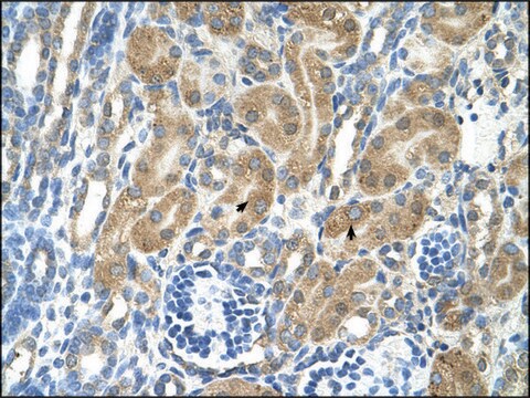 Anti-PARL antibody produced in rabbit affinity isolated antibody