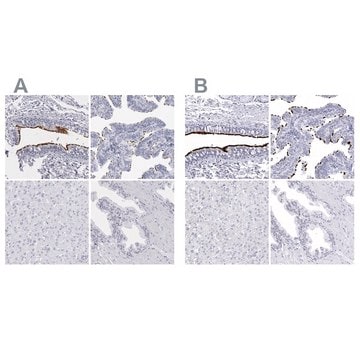 Anti-CCDC181 antibody produced in rabbit Prestige Antibodies&#174; Powered by Atlas Antibodies, affinity isolated antibody, buffered aqueous glycerol solution, ab2