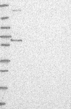 Anti-ETV3 antibody produced in rabbit Prestige Antibodies&#174; Powered by Atlas Antibodies, affinity isolated antibody, buffered aqueous glycerol solution