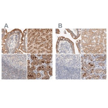 Anti-HDHD3 antibody produced in rabbit Prestige Antibodies&#174; Powered by Atlas Antibodies, affinity isolated antibody, buffered aqueous glycerol solution, Ab3